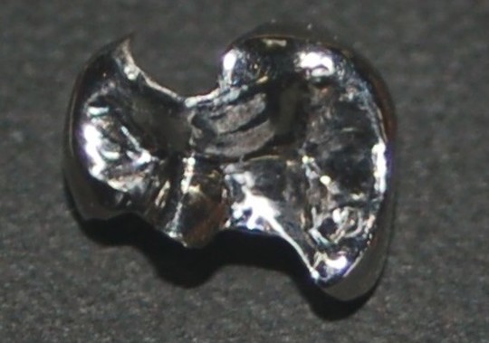 どんな治療が相応しい？（価格表） - つゆくさ歯科医院（名古屋市緑区）